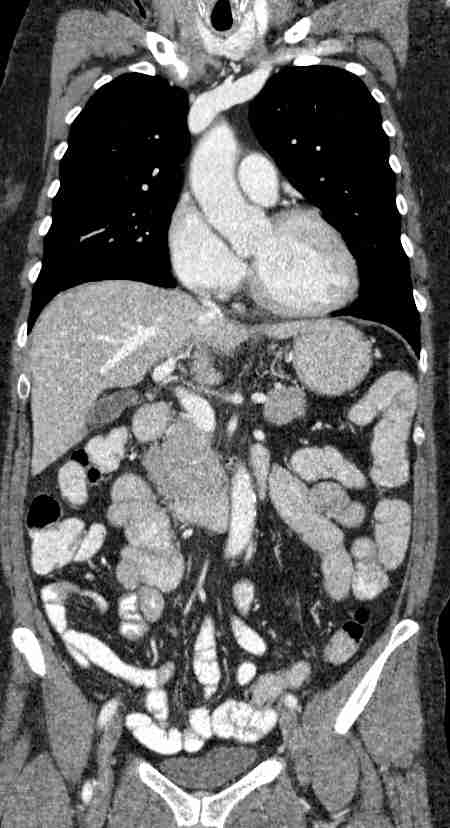 Female CT Browser: © 2013 - 2017 D. Jansma & M.C. de Ruiter,dept. of ...